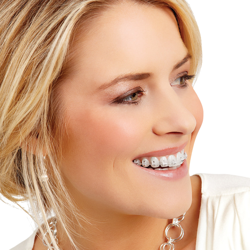 Orthodontic patient wearing Radiance braces